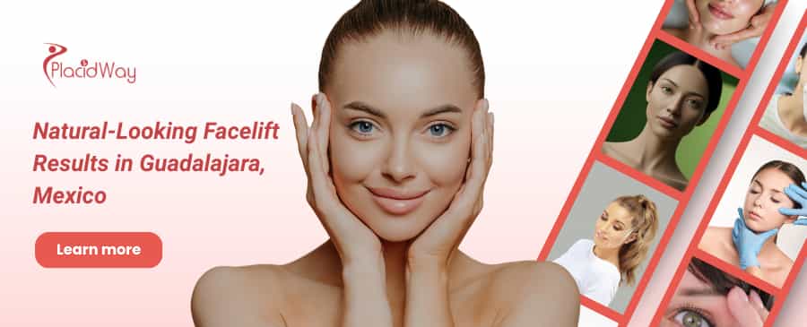 Rejuvenecimiento facial en Guadalajara, México thumbnail