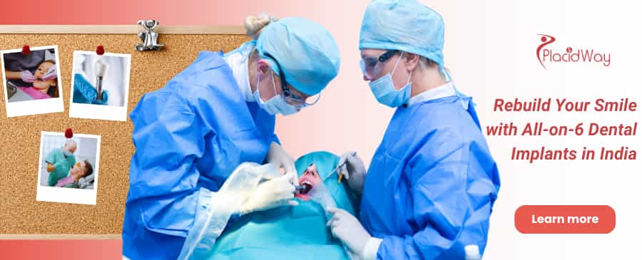 All-on-6 Dental Implants in Mumbai, India thumbnail