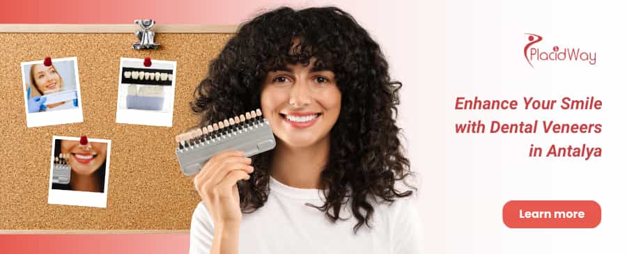 Carillas dentales en Antalya thumbnail