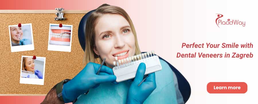 Carillas dentales en Zagreb, Croacia thumbnail