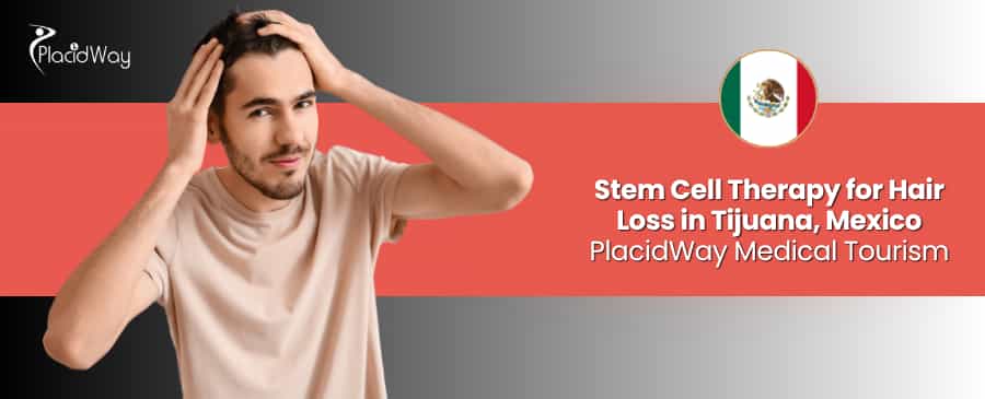 Stem Cell Therapy for Hair Loss in Tijuana, Mexico thumbnail