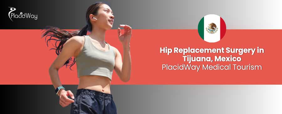 Reemplazo de Cadera en Tijuana - Mejore la Salud de su Cadera thumbnail