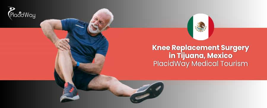 Reemplazo de Rodilla en Tijuana - Recupere la Salud de sus Rodillas thumbnail