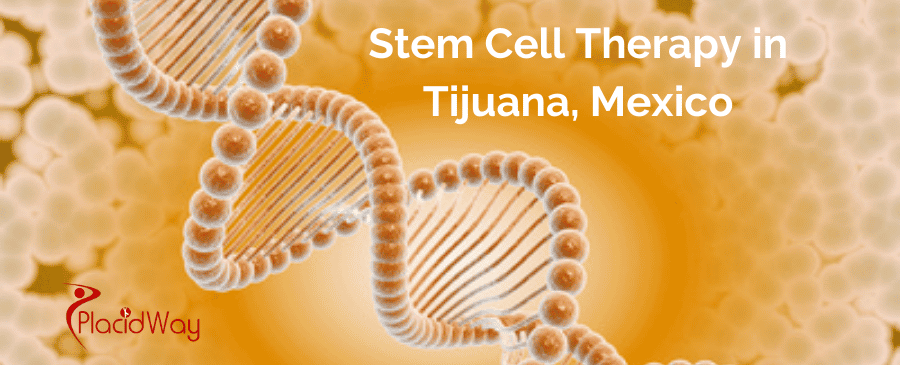 Stem Cell Therapy in Tijuana, Mexico