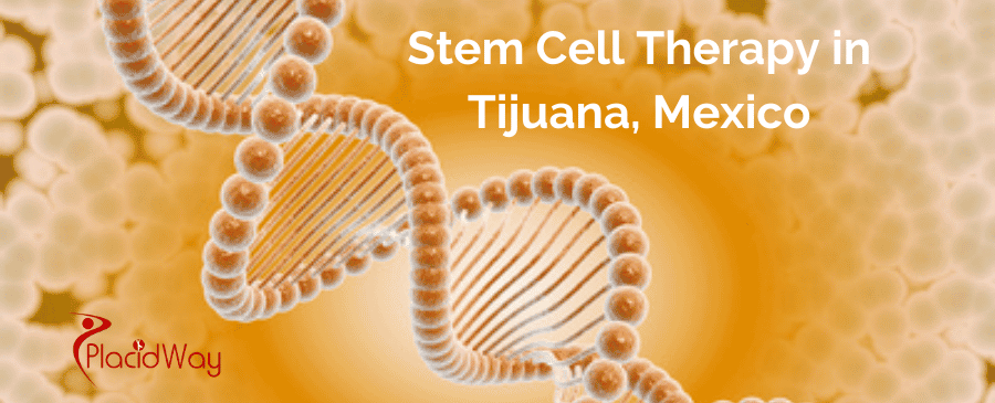 Stem Cell Therapy in Tijuana, Mexico