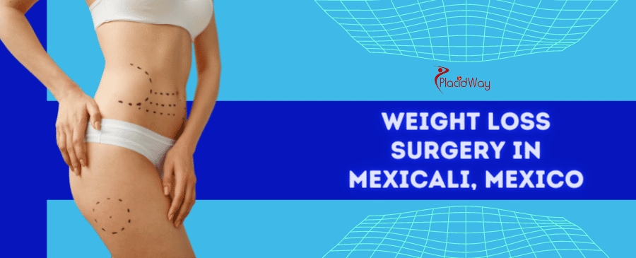 Weight Loss Surgery in Mexicali, Mexico