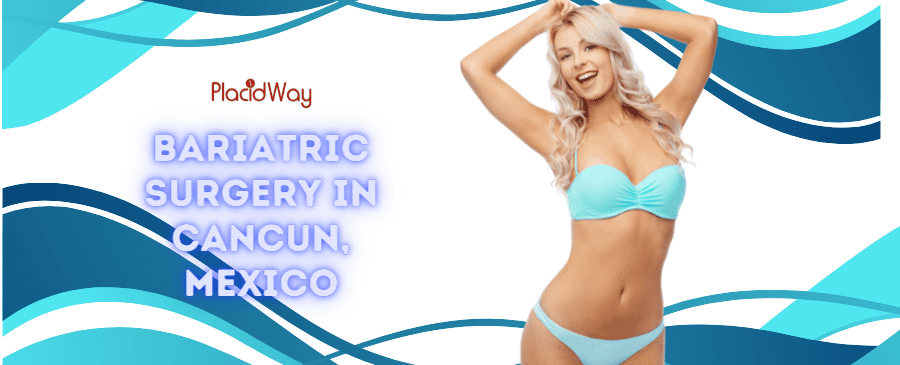 Bariatric Surgery in Cancun, Mexico - The Ultimate Guide