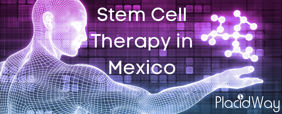 Stem Cell Therapy in Mexico