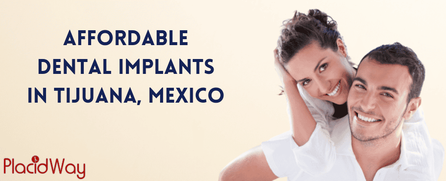Affordable Dental Implants in Tijuana, Mexico