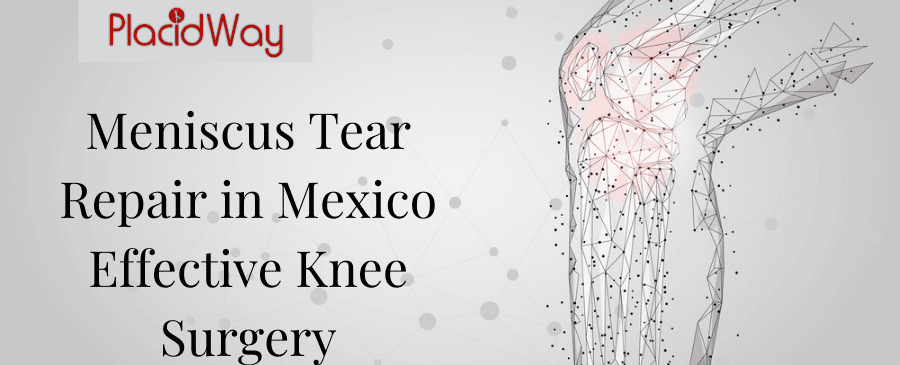 Meniscus Tear Repair in Mexico - Effective Knee Surgery