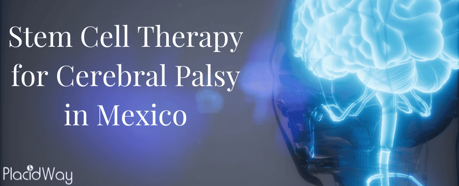 Stem Cell Therapy for Cerebral Palsy: A New Hope in Mexico