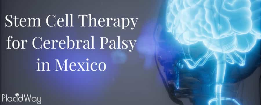 Stem Cell Therapy for Cerebral Palsy: A New Hope in Mexico