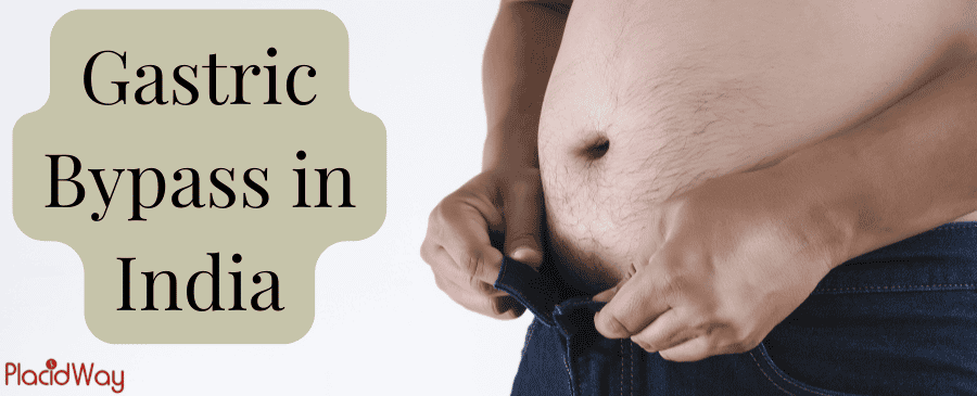 Lose Weight with Gastric Bypass in India