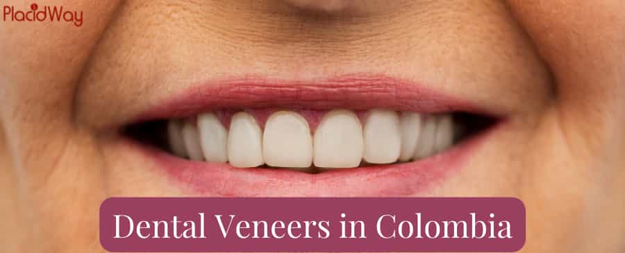 Get Cheap and Safe Dental Veneers in Colombia