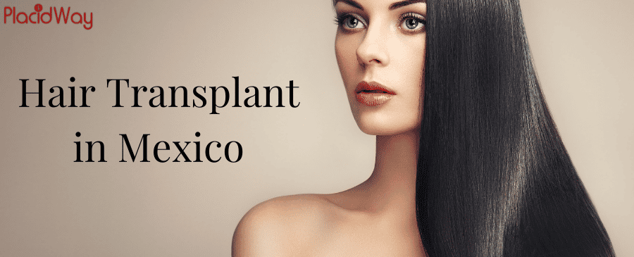 The Guide to Choosing Hair Transplant in Mexico