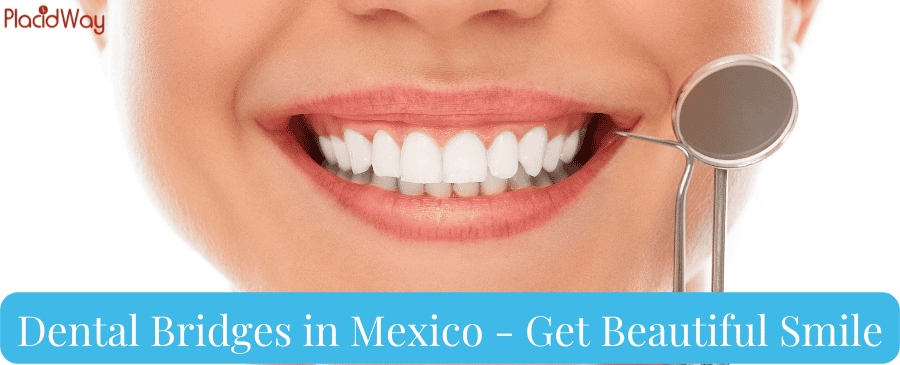 Dental Bridges in Mexico - Get Beautiful Smile
