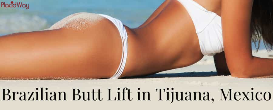 Brazilian Butt Lift in Tijuana, Mexico - Your Butt Lift Solution