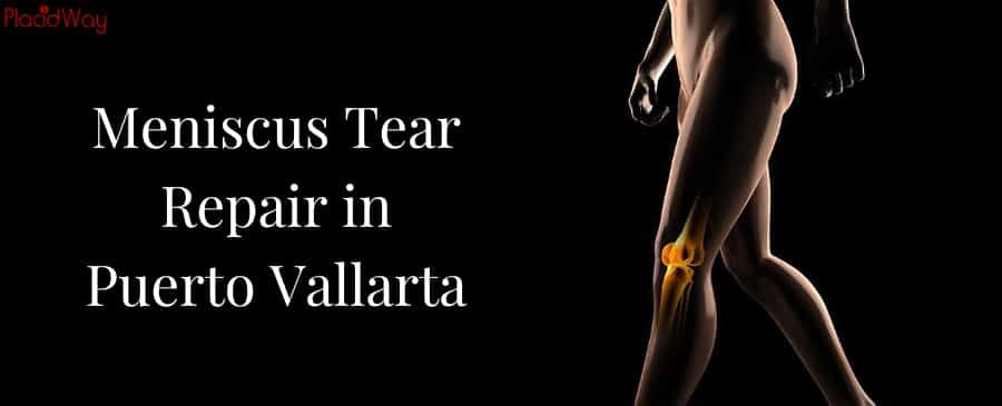 Meniscus Tear Repair in Puerto Vallarta, Mexico