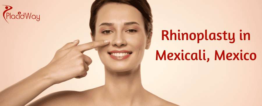Rhinoplasty in Mexicali, Mexico