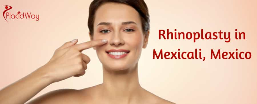 Rhinoplasty in Mexicali, Mexico