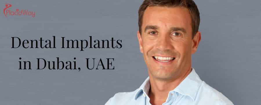 Dental Implants in Dubai