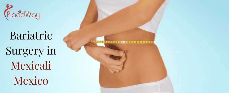 Bariatric Surgery in Mexicali Mexico