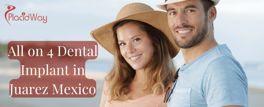 All on 4 Dental Implants in Juarez Mexico