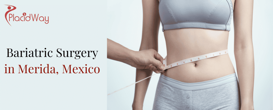 Bariatric Surgery in Merida, Mexico