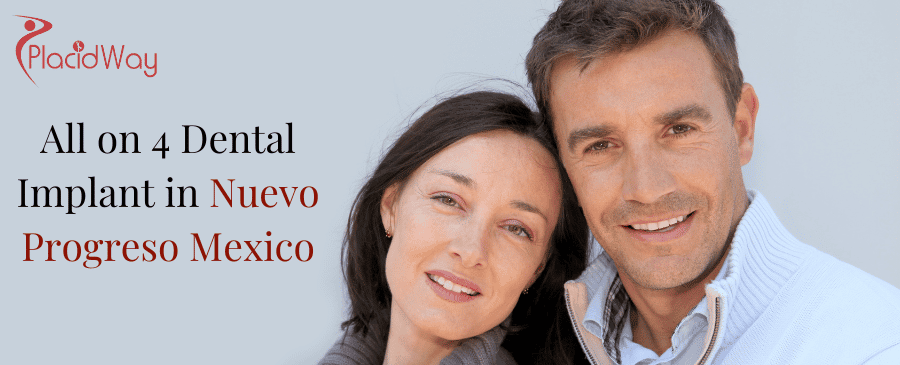 All-on-4 Dental Implants in Nuevo Progreso Mexico