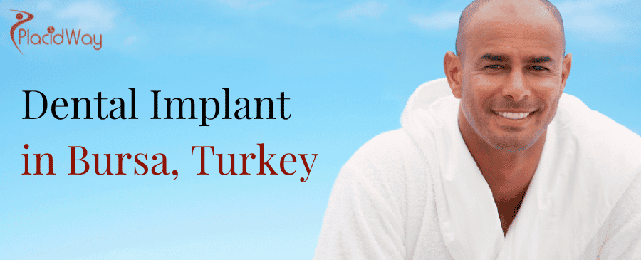 Dental Implant in Bursa, Turkey