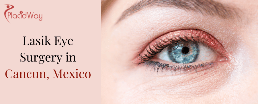 Lasik Eye Surgery in Cancun, Mexico