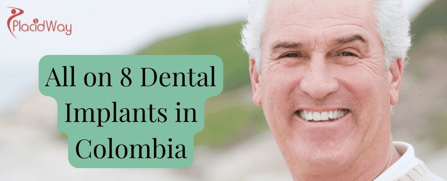 All on 8 Dental Implants in Colombia