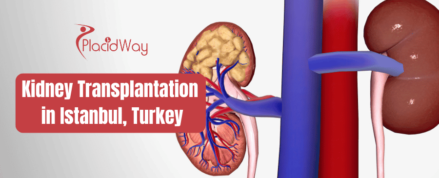 Kidney Transplantation in Istanbul, Turkey