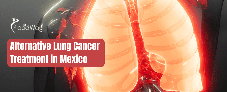 Alternative Lung Cancer Treatment in Mexico