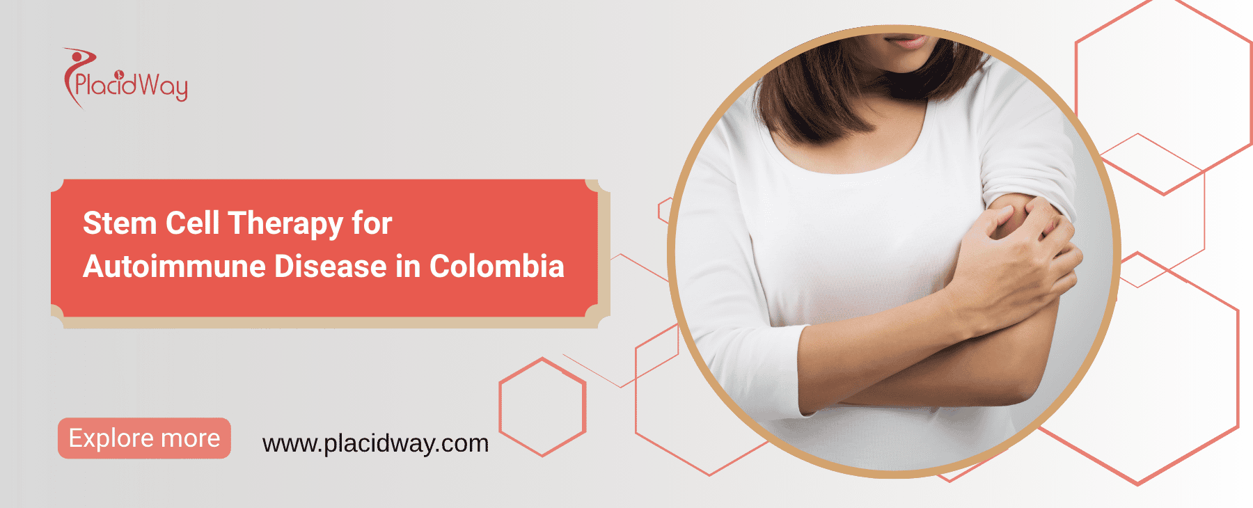 Stem Cell Therapy for Autoimmune Disease in Colombia thumbnail