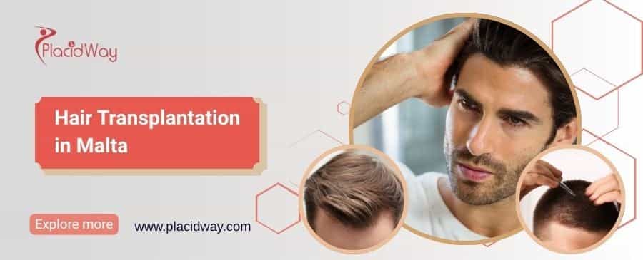 Hair Transplantation in Malta thumbnail