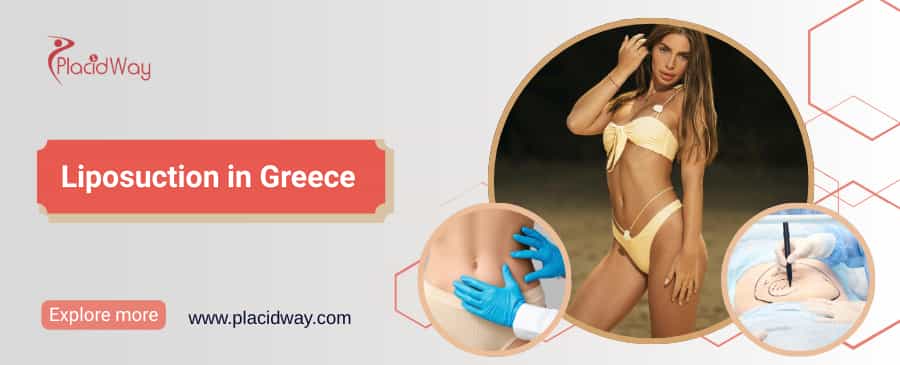 Liposuction in Greece thumbnail
