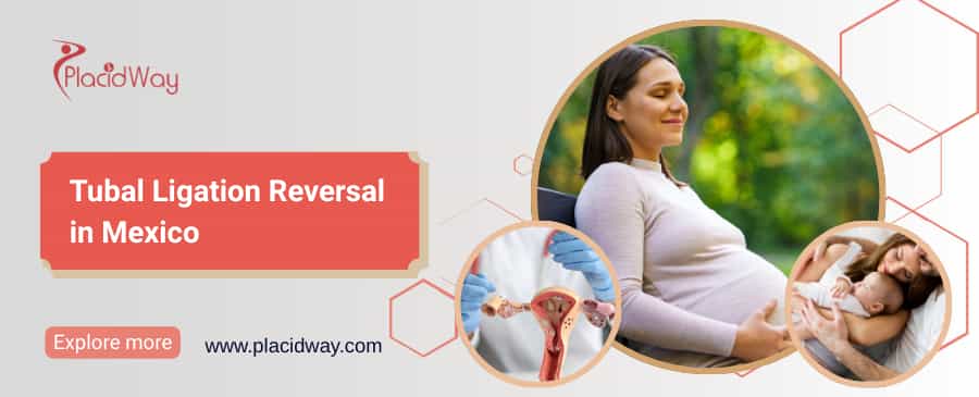 Tubal Ligation Reversal in Mexico thumbnail