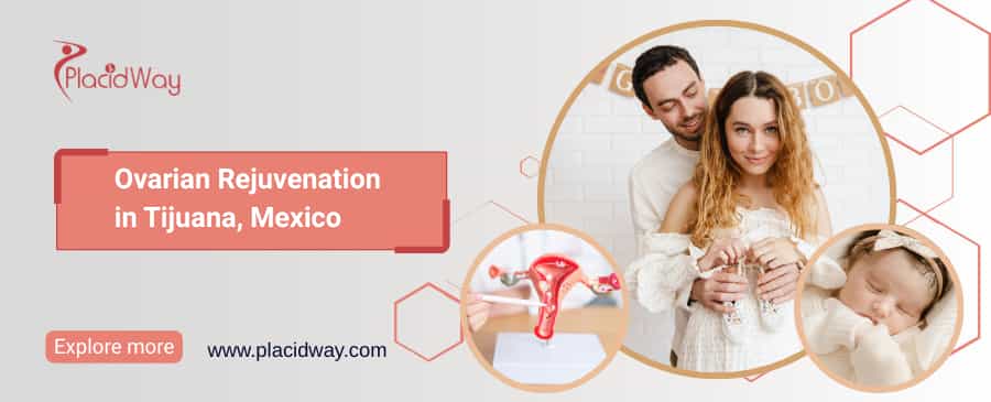 Ovarian Rejuvenation in Tijuana, Mexico thumbnail