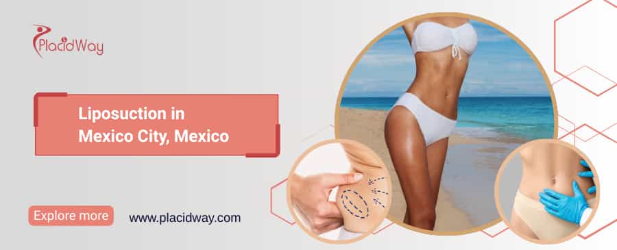 Liposuction in Mexico City, Mexico thumbnail