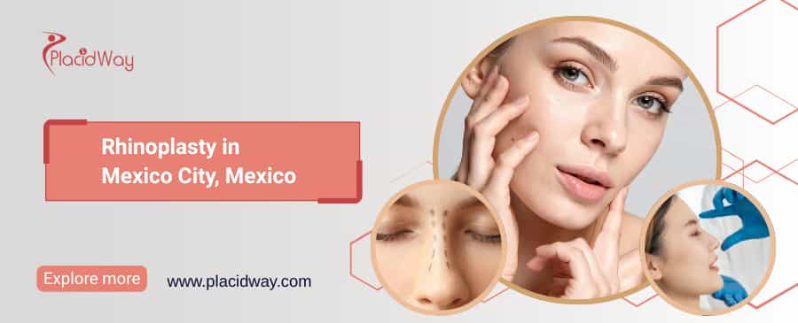Rhinoplasty in Mexico City, Mexico thumbnail