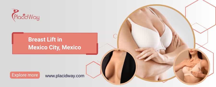 Breast Lift in Mexico City, Mexico thumbnail