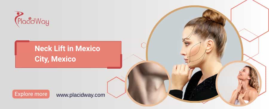 Neck Lift in Mexico City, Mexico thumbnail