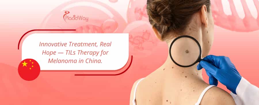Immunotherapy China: TILs Therapy for Melanoma thumbnail
