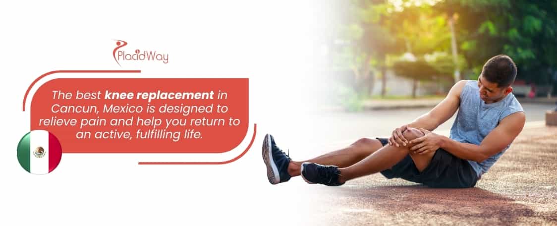 Best Knee Replacement in Cancun Mexico from Top-Rated Hospital thumbnail