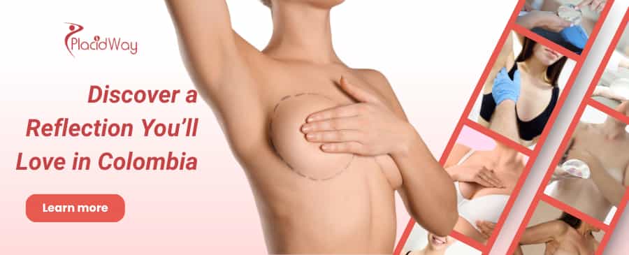 Breast Augmentation in Colombia thumbnail