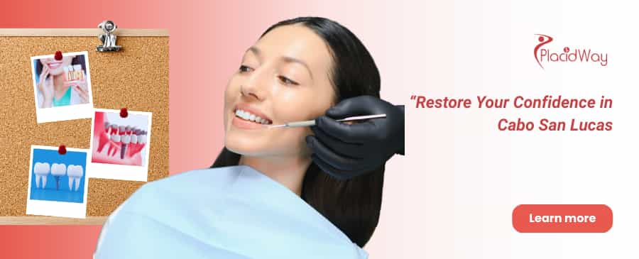 All on 4 Implants in Cabo San Lucas thumbnail