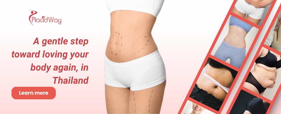 Tummy Tuck in Thailand thumbnail