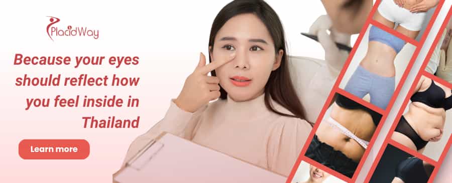 泰国眼睑手术 thumbnail