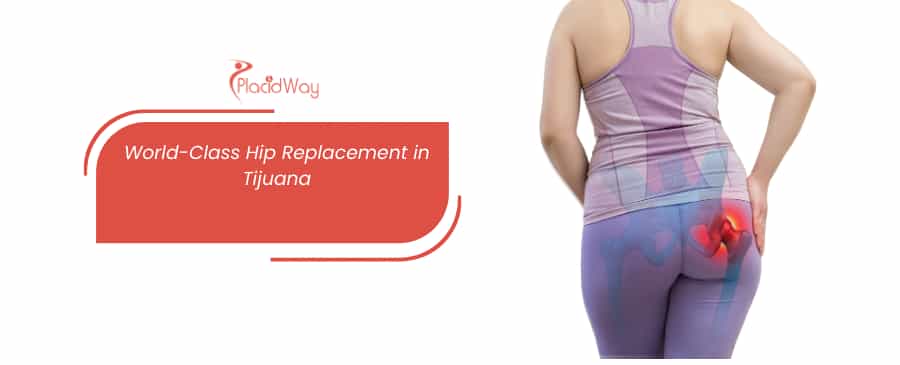 Hip Replacement Surgery in Tijuana, Mexico thumbnail